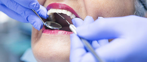 Best Emergency Treatment for Dental Infections or Abscesses in Bellville, OH